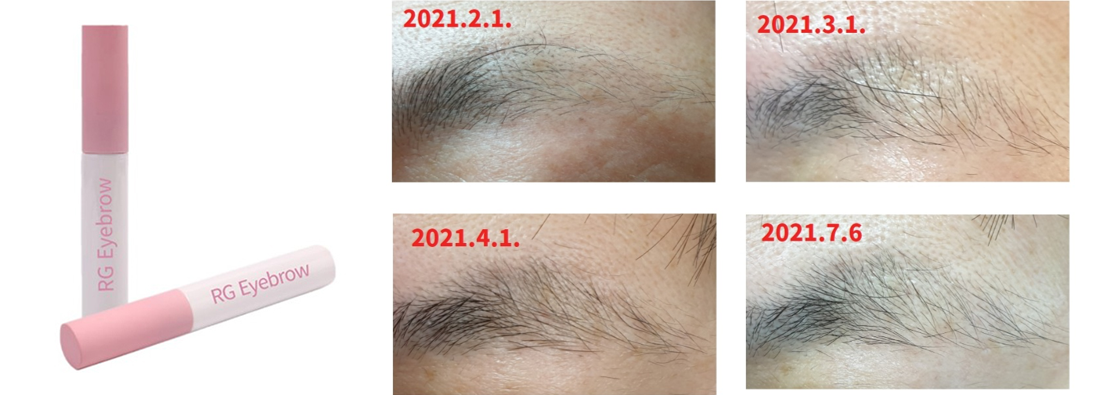RG EYEBrow ´«½ç Áõ¸ðÁ¦